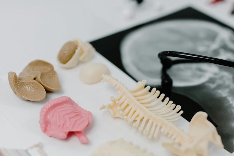 Mengenal Kanker Paru: Tanda dan Gejala Serta Cara Mengurangi Risiko Terkena